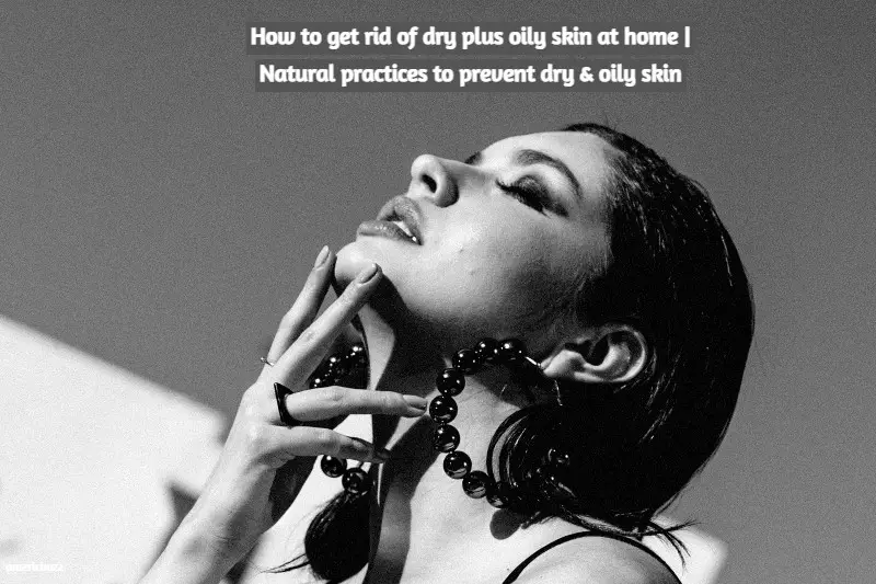 How to get rid of dry plus oily skin at home | Natural practices to prevent dry & oily skin